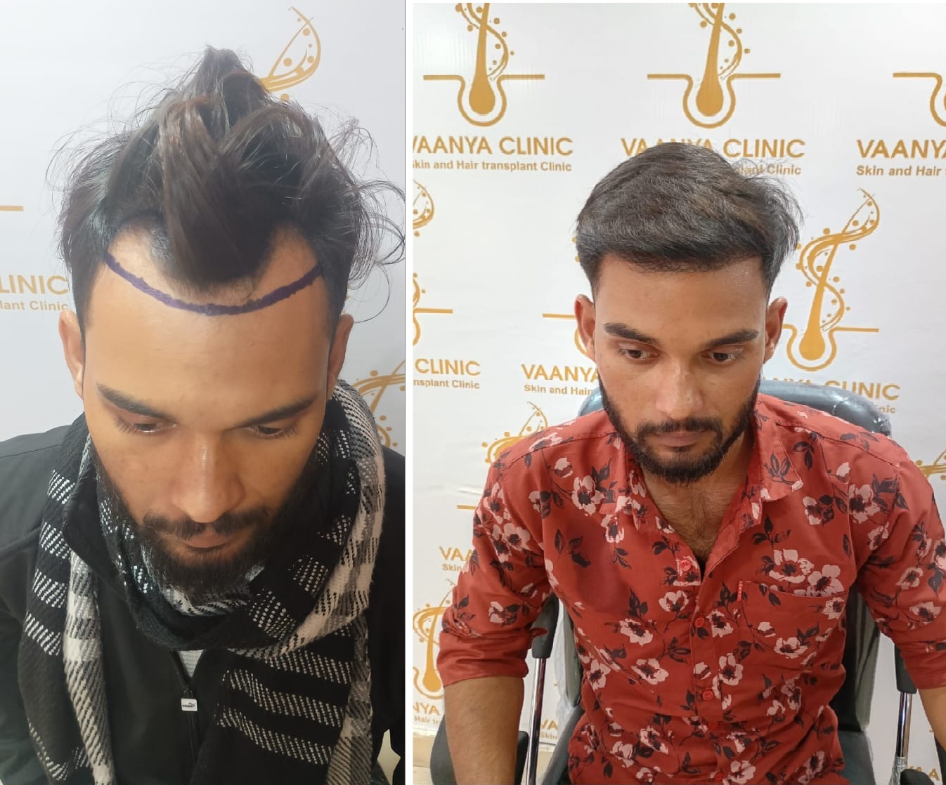 Patient result preview: before & after