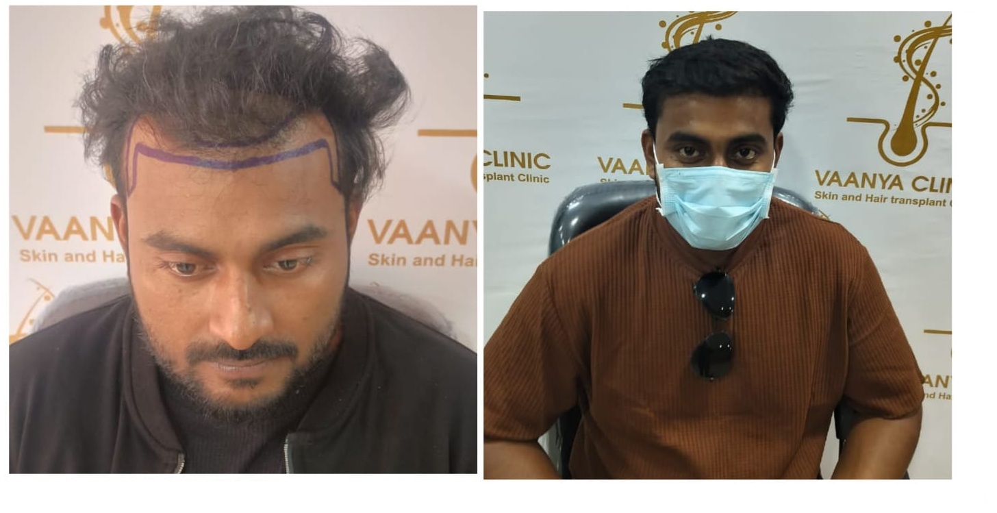 Patient speaking after procedure at clinic backdrop